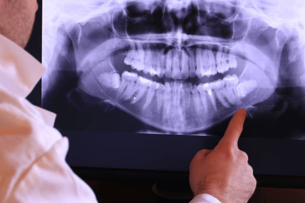 Best Emergency Care for Gum Disease in Crete, NE